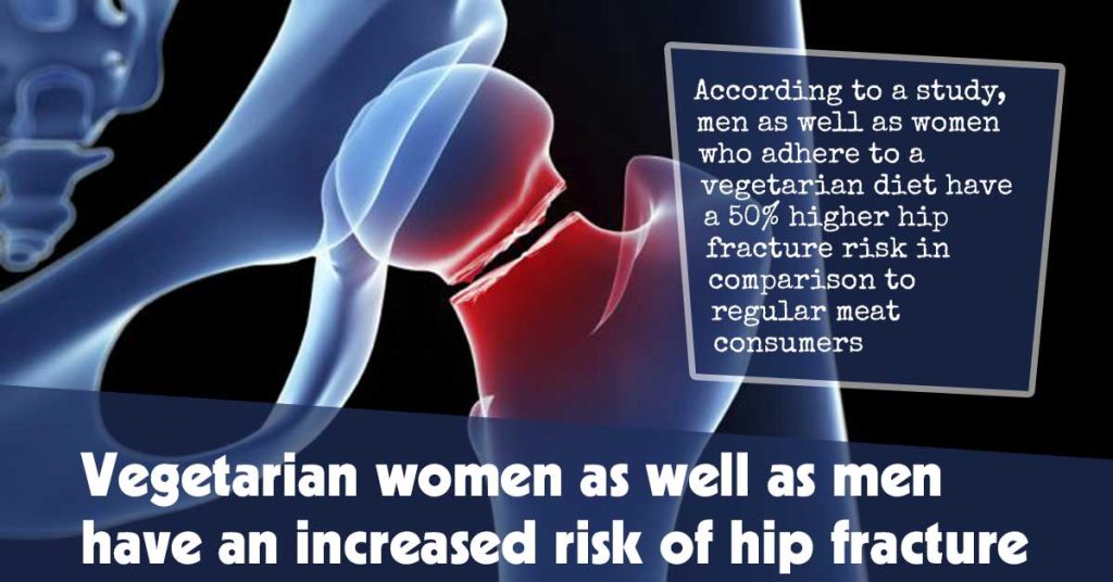 Vegetarian Women As Well As Men Have An Increased Risk Of Hip Fracture F