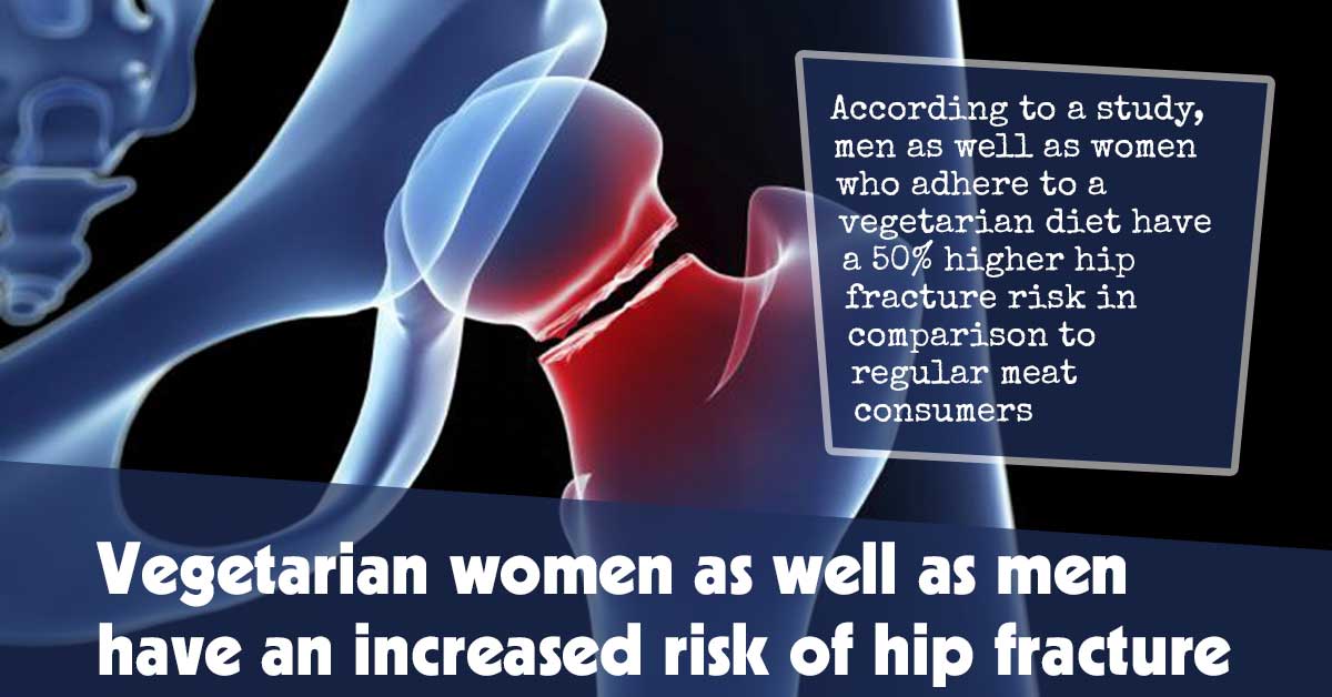 Vegetarian Women As Well As Men Have An Increased Risk Of Hip Fracture F